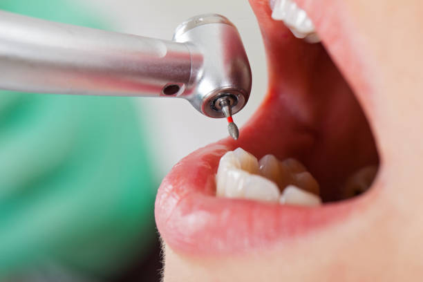 Best Emergency Tooth Extraction in Perry Heights, OH